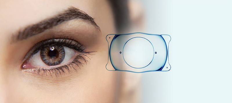 EVO ICL Implant